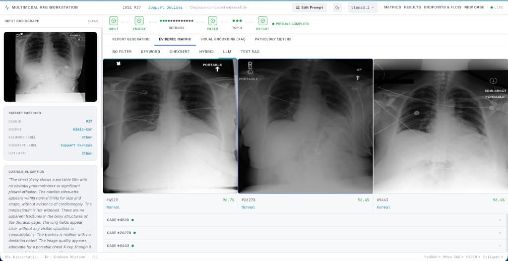 Evidence matrix showing top three retrieved chest X-rays with similarity scores and filter comparison